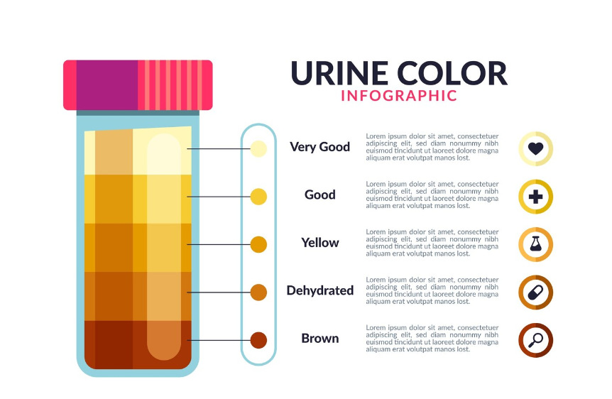 Nước tiểu có nhiều màu sắc khác nhau